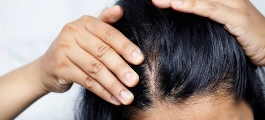 Comprendre la folliculite cuir chevelu : causes et solutions efficaces