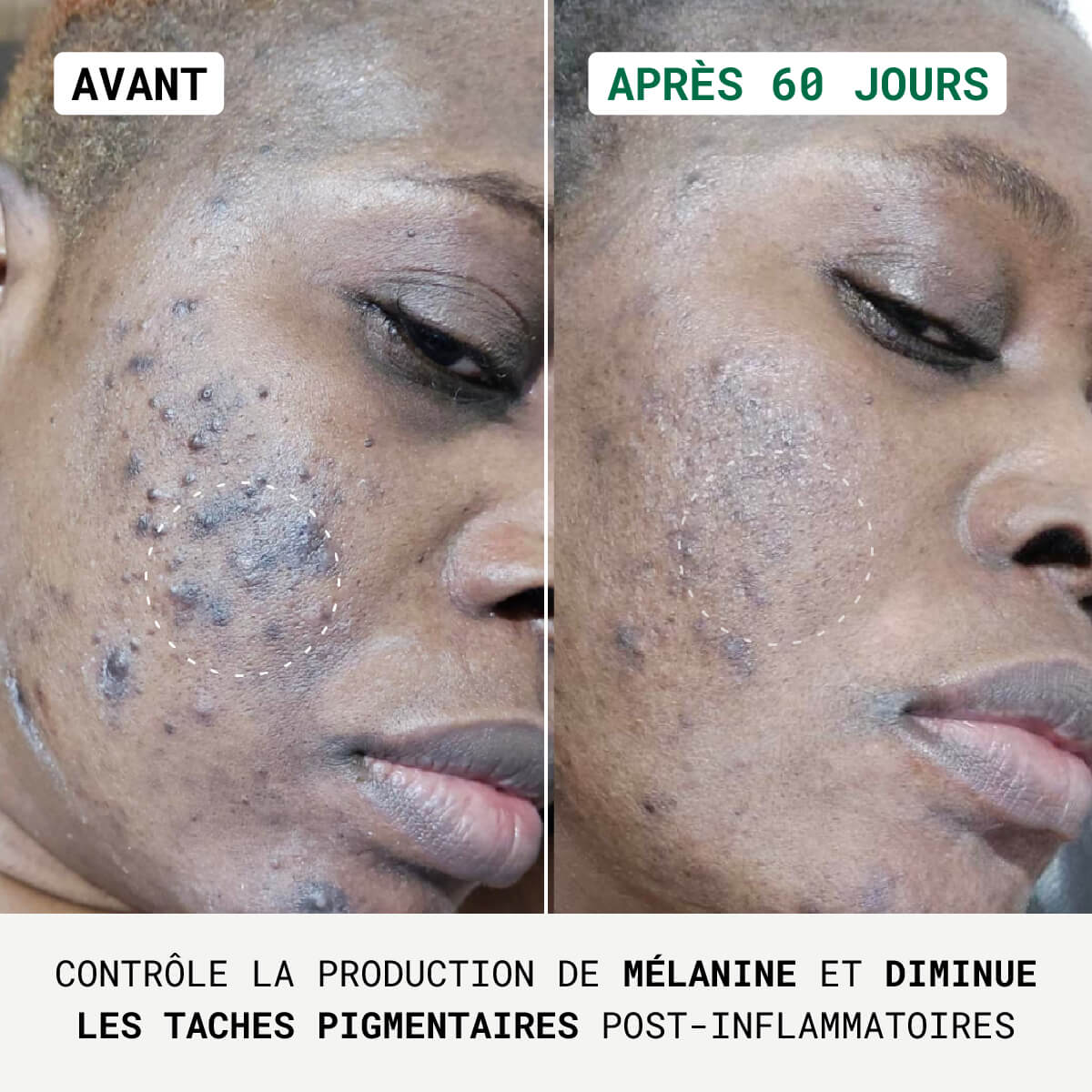 Routine Anti-Taches Visage & Corps