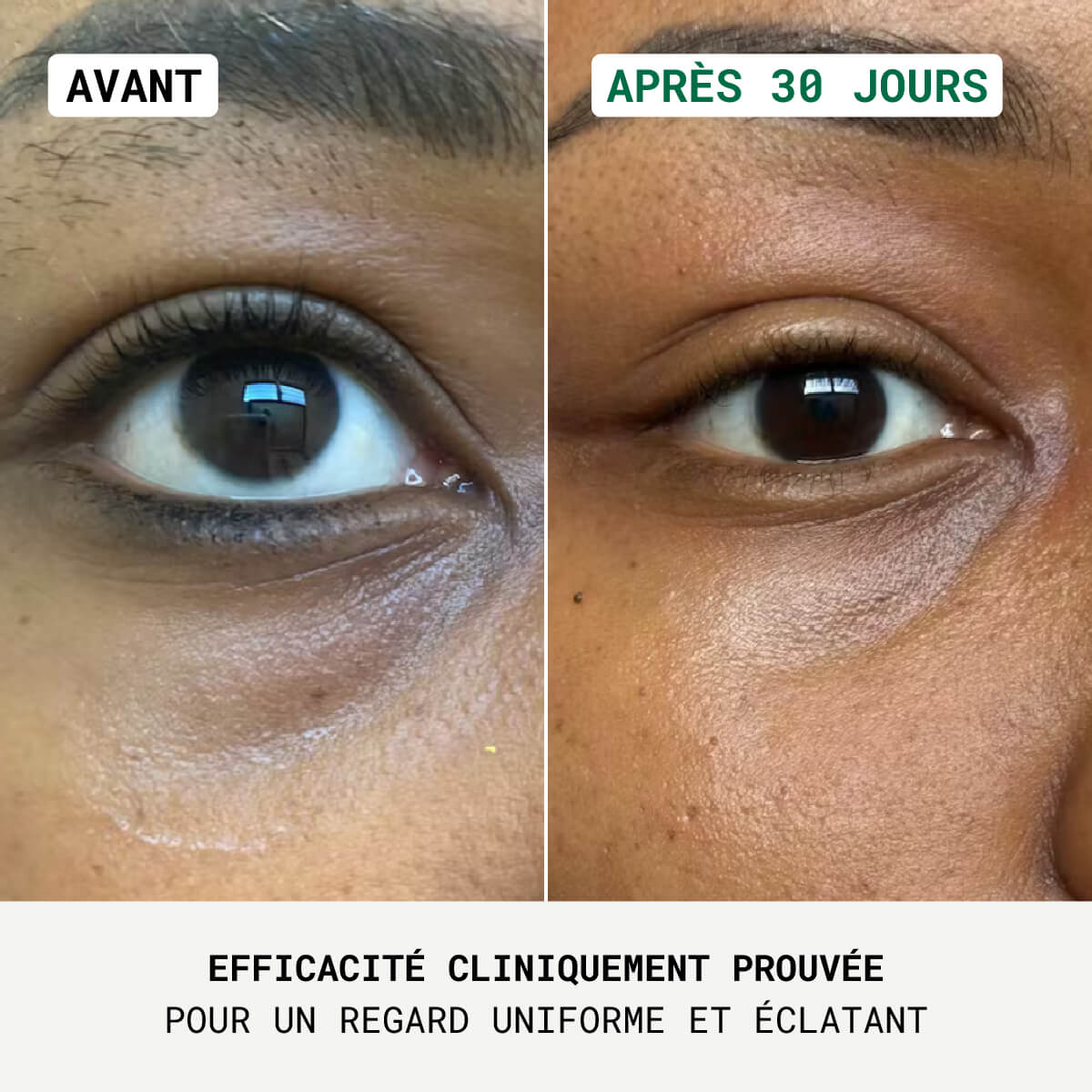 EYE RE-7® - Correcteur Contour des Yeux