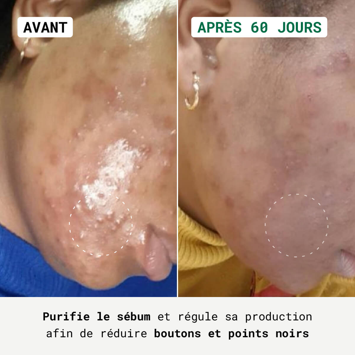 Routine Anti-Imperfections