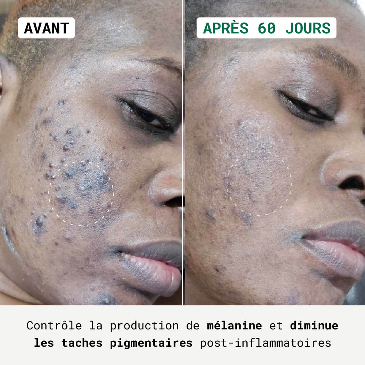Routine Anti-Taches Visage & Corps