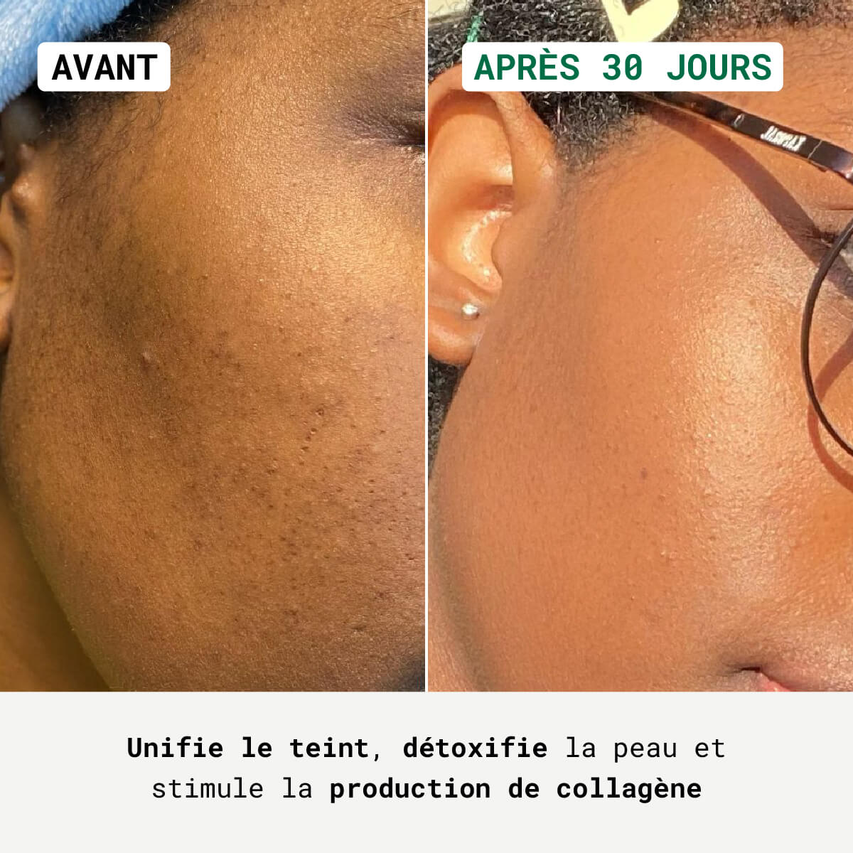Anti-Dark Spot Night Cream