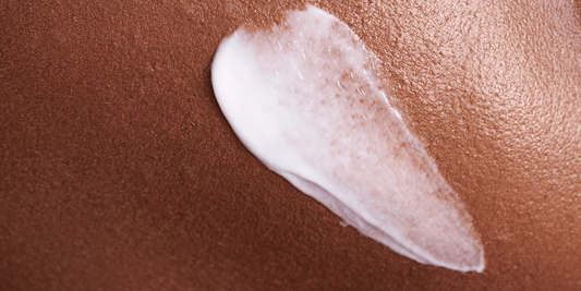Coup de soleil sur peau noire : causes, symptômes et solutions
