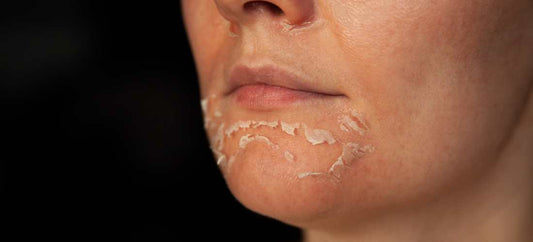 Peeling visage : tout ce que vous devez savoir pour une peau éclatante