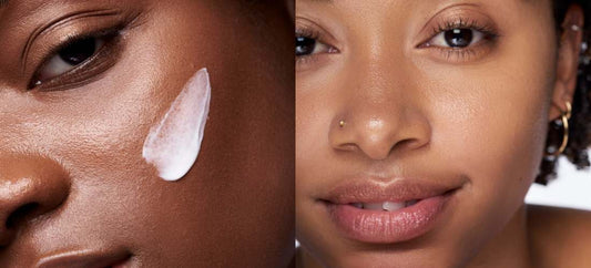 Prendre soin de sa peau : conseils essentiels pour chaque type de peau