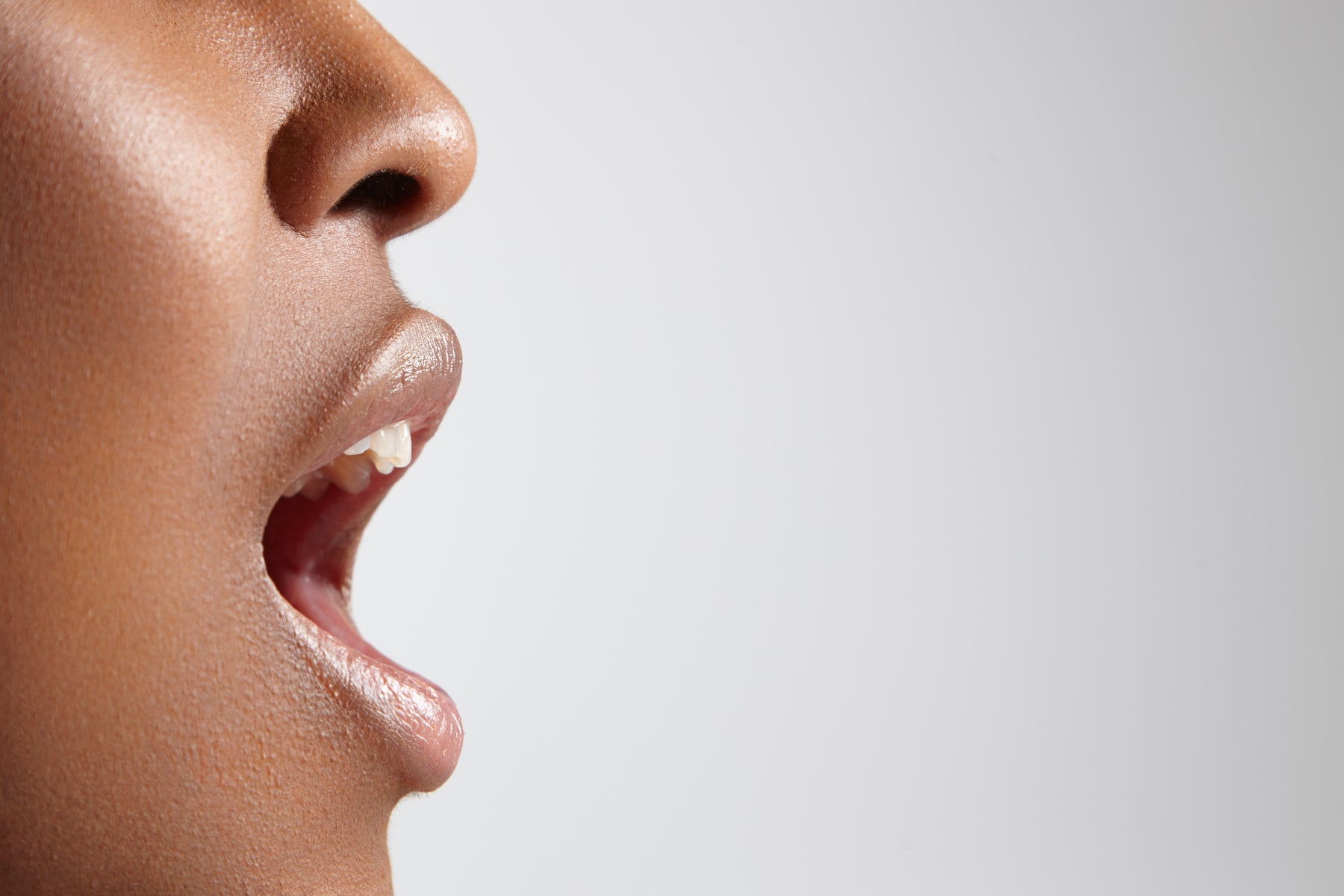 SOS lèvres gercées : comment en prendre soin ?