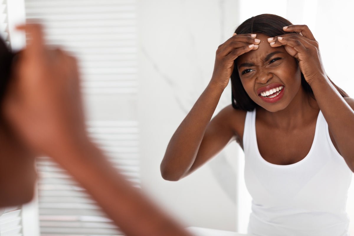 Top 5 des erreurs à éviter en cas d'acné sur peau noire