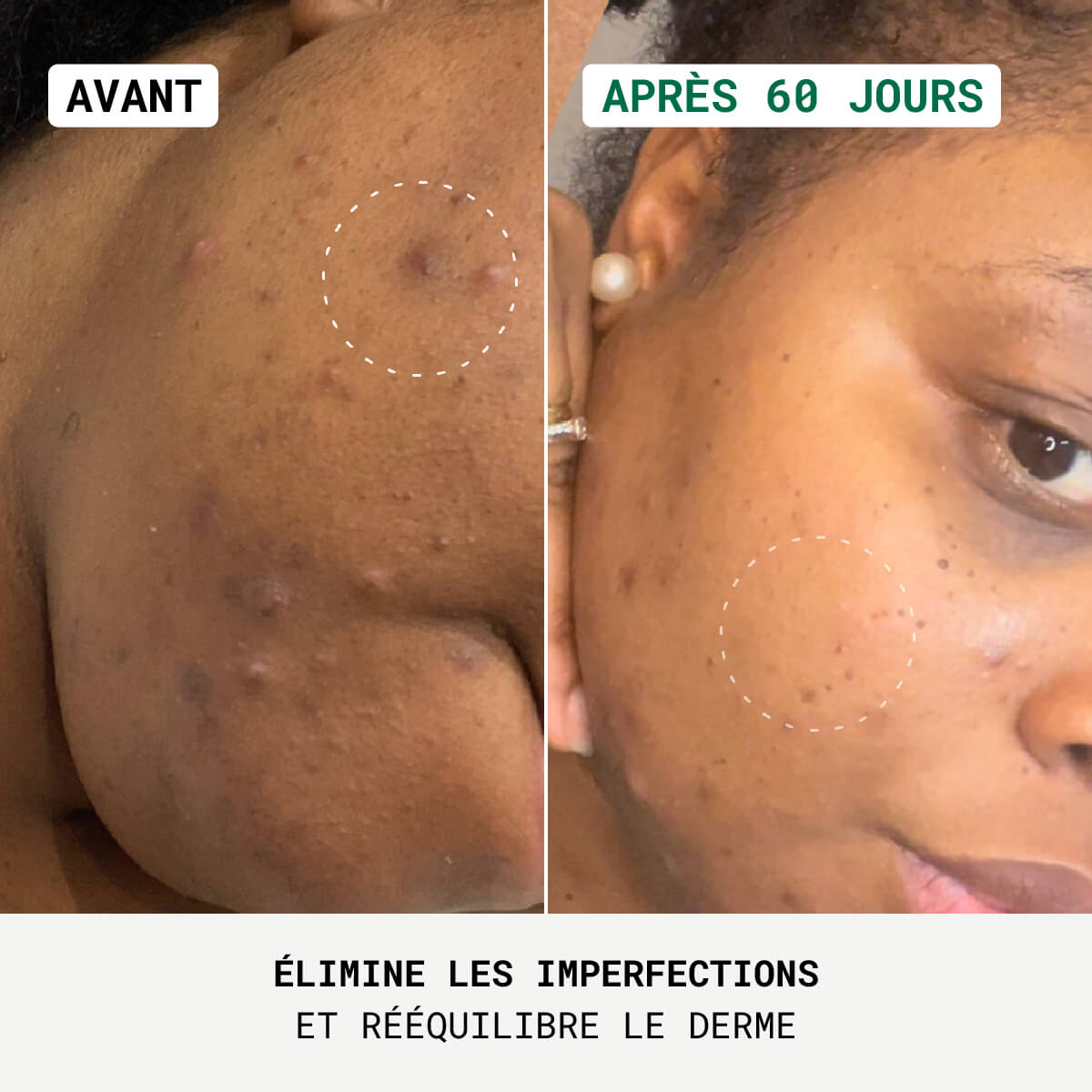 Trio Anti-Imperfections
