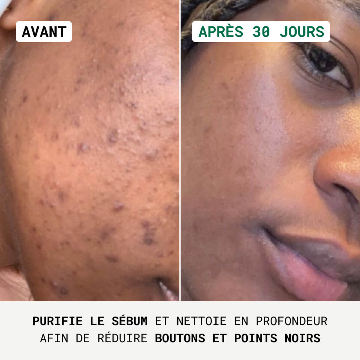 Duo Anti-Imperfections