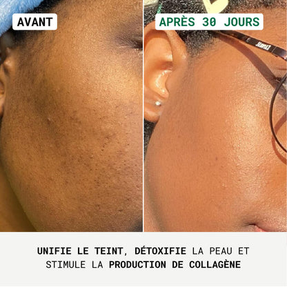 Crème de nuit Anti-Taches