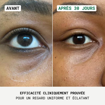 EYE RE-7® - Correcteur Contour des Yeux