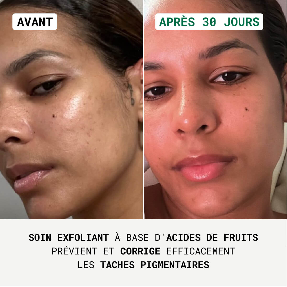 Sérum Anti-Taches