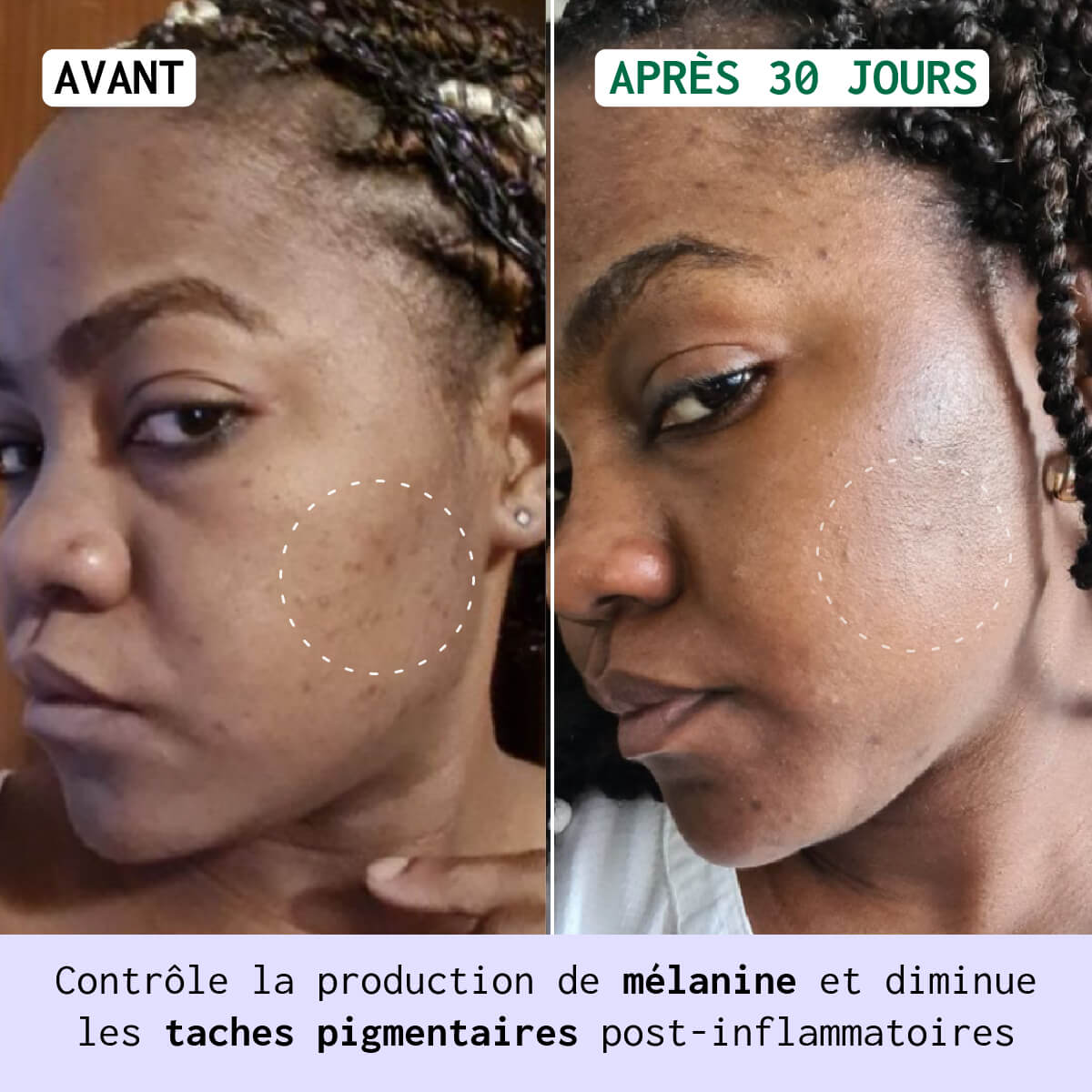 Duo Anti-Taches Jour & Nuit