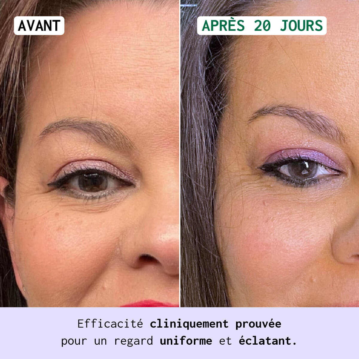 EYE RE-7® - Contour des yeux Multi-correcteur