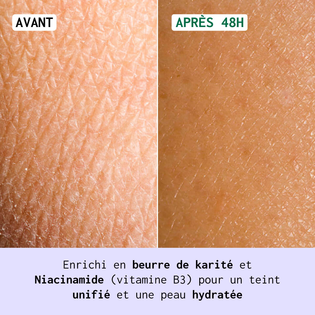 Close-up comparison of dry skin before and after using a moisturizing product.