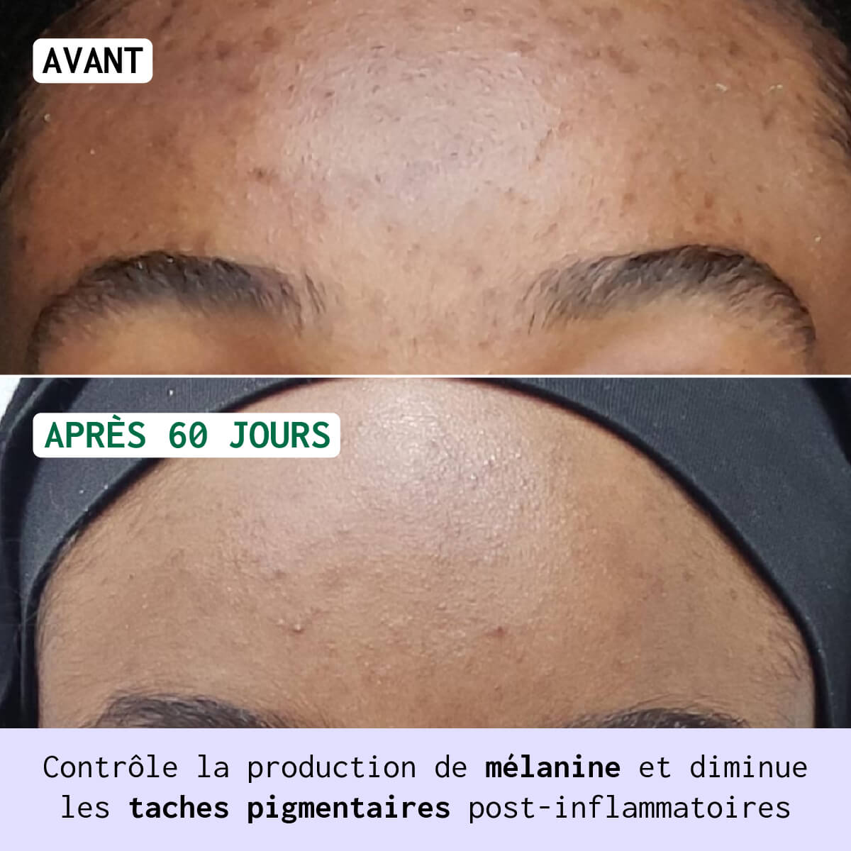 Routine Anti-Taches - Visage