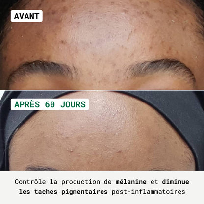 Routine Anti-Taches - Visage