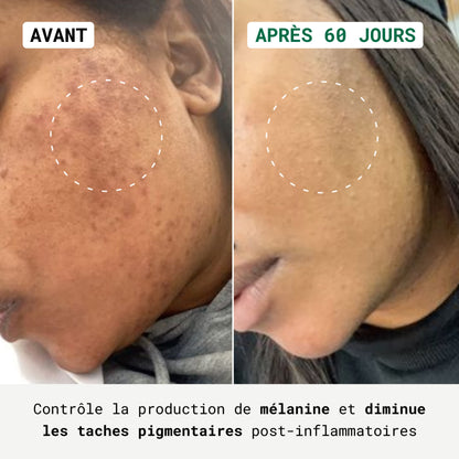 Routine Anti-Taches Visage & Corps