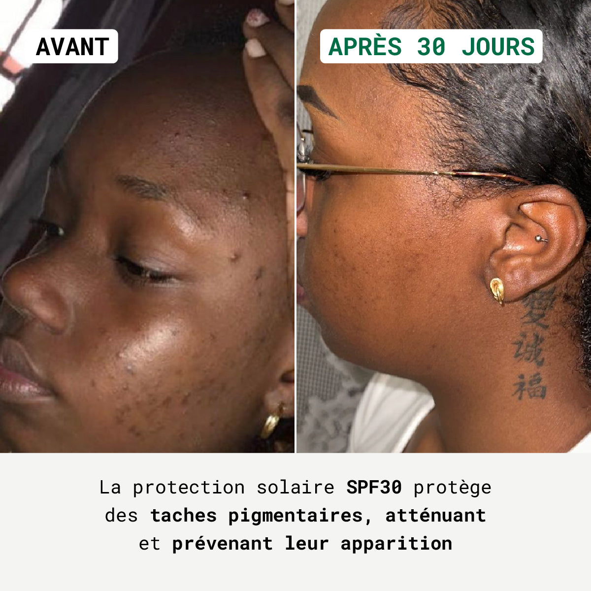 Routine Anti-Teint Terne Visage