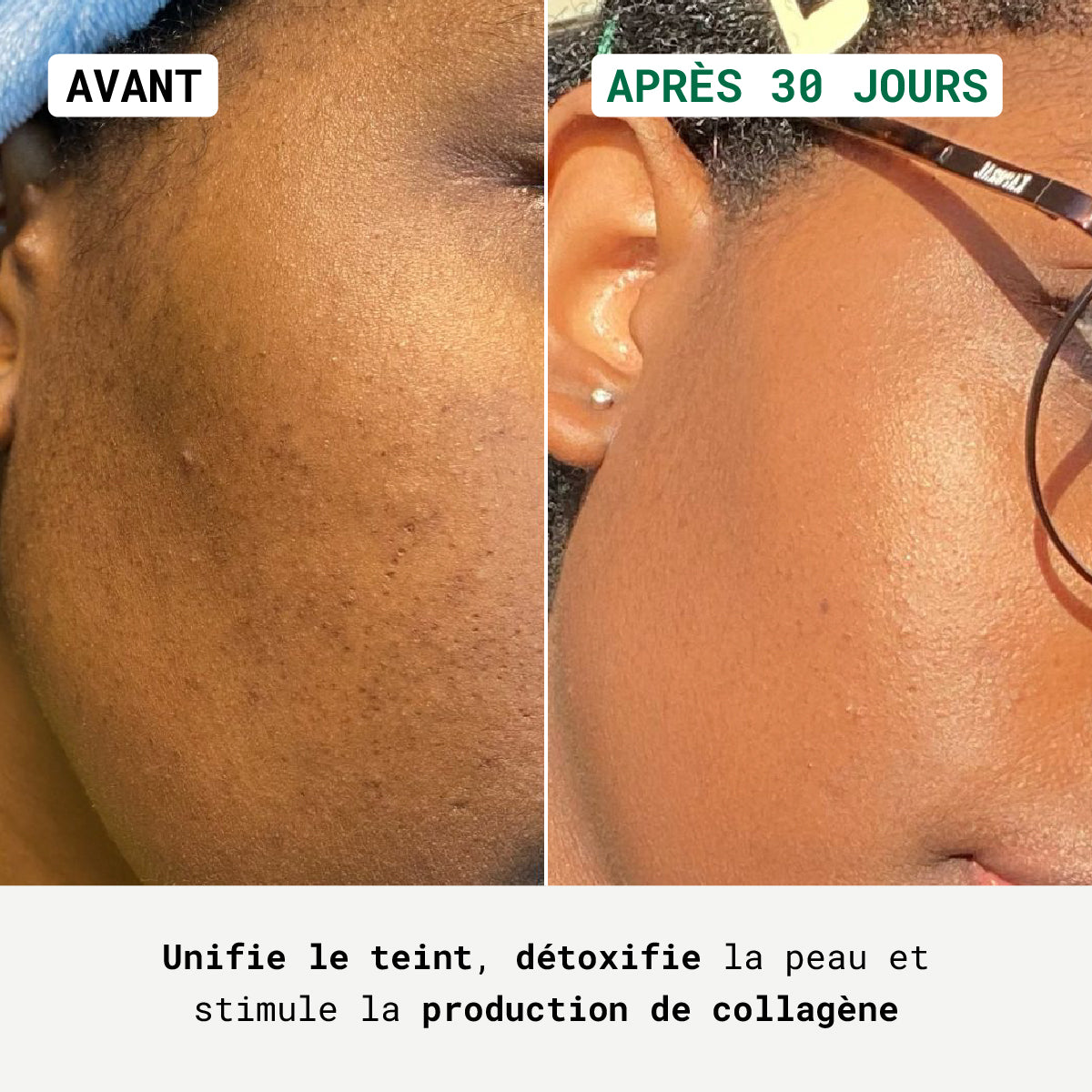 Routine Anti-Teint Terne Visage
